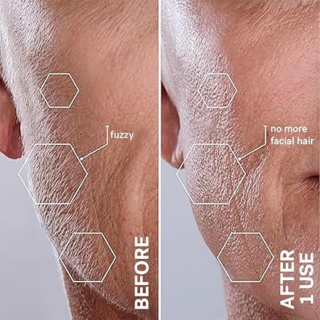 Sonic Dermaplaning Tool