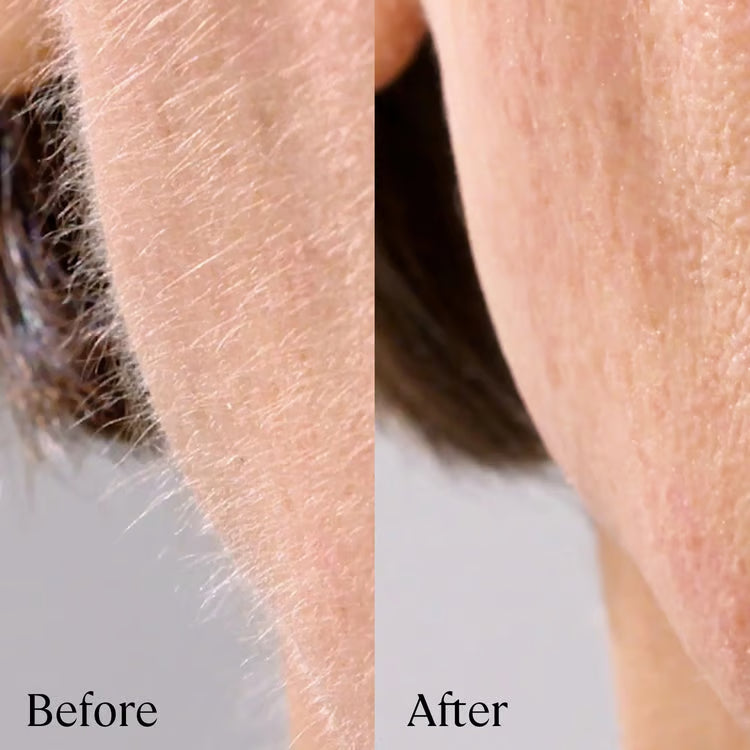 Sonic Dermaplaning Tool